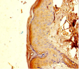 PGLYRP4 Polyclonal Antibody