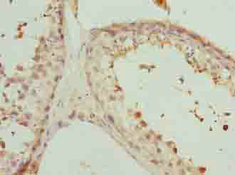 PHF13 Polyclonal Antibody