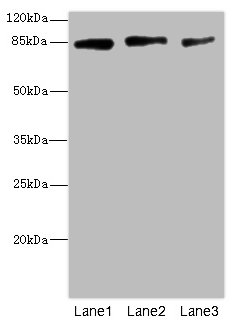 PLOD2 Polyclonal Antibody