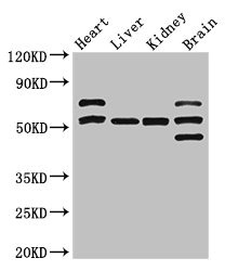 PNLIPRP3 Polyclonal Antibody