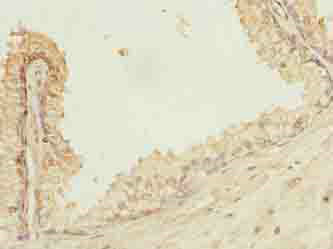 POGZ Polyclonal Antibody (50 µl)