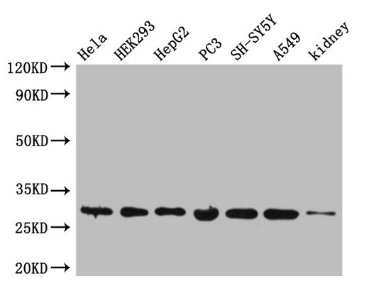POLR2C Polyclonal Antibody