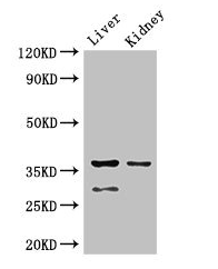 PPP2CA Polyclonal Antibody (50 µl)