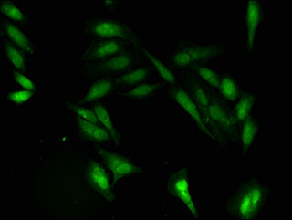PRIM1 Polyclonal Antibody