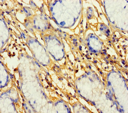 PROKR1 Polyclonal Antibody
