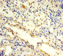 PSMC3 Polyclonal Antibody