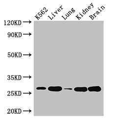 QDPR Polyclonal Antibody