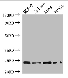 RAB25 Polyclonal Antibody