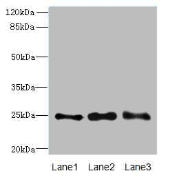 RAB3B Polyclonal Antibody