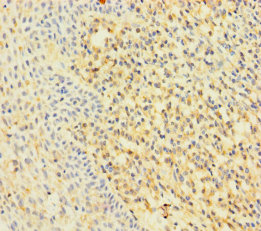 RAC2 Polyclonal Antibody
