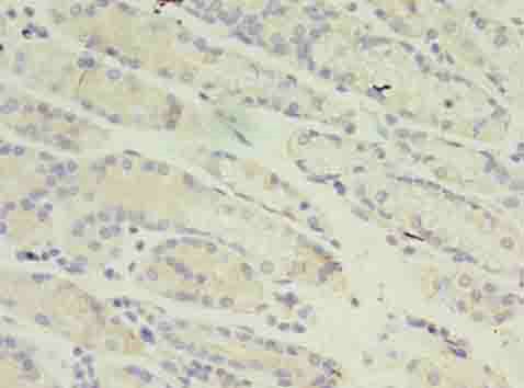 RANBP2 Polyclonal Antibody