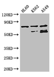 RARS Polyclonal Antibody