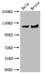 RASA1 Polyclonal Antibody