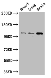 RBM10 Polyclonal Antibody