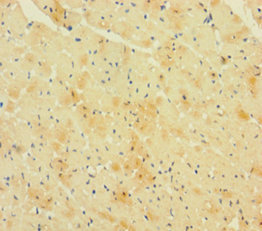 RCAN1 Polyclonal Antibody