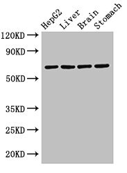 RCBTB2 Polyclonal Antibody