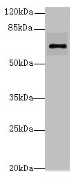 RHOBTB3 Polyclonal Antibody