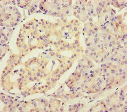 RPL34 Polyclonal Antibody