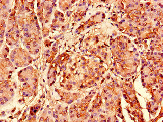 RPS26 Polyclonal Antibody