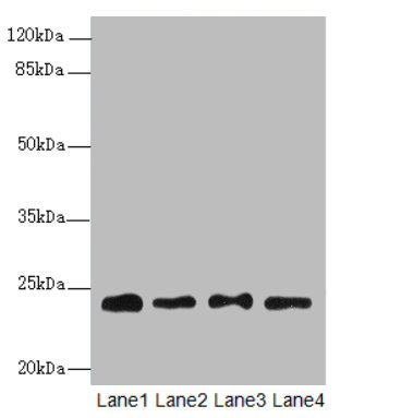 RPS8 Polyclonal Antibody