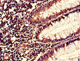 S100A10 Polyclonal Antibody