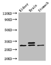 SCGN Polyclonal Antibody
