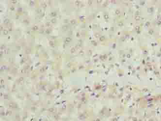 SCLT1 Polyclonal Antibody