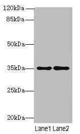 SDSL Polyclonal Antibody