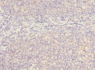 SLC17A3 Polyclonal Antibody