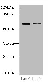 SLC1A6 Polyclonal Antibody