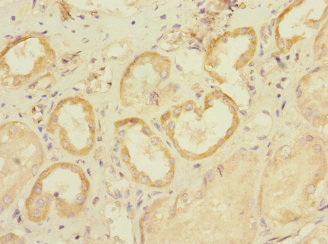 SLC28A1 Polyclonal Antibody