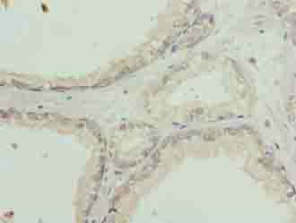 SLC31A2 Polyclonal Antibody
