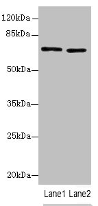 SLC6A6 Polyclonal Antibody