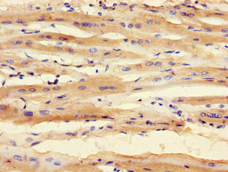 SMNDC1 Polyclonal Antibody