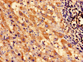 SOCS3 Polyclonal Antibody