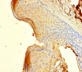 SPRR1B Polyclonal Antibody