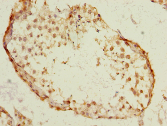 SST Polyclonal Antibody