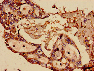 SST Polyclonal Antibody