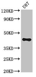 ST8SIA5 Polyclonal Antibody