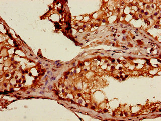 STAT1 Polyclonal Antibody