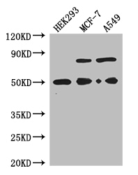 TCN2 Polyclonal Antibody