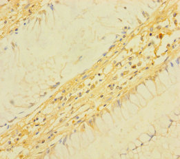 TM4SF5 Polyclonal Antibody