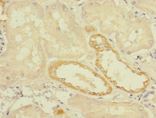 TMEM139 Polyclonal Antibody
