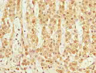 TMEM205 Polyclonal Antibody