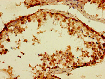 Immunohistochemistry of paraffin-embedded human testis tissue using TPSB2 Polyclonal Antibody at dilution of 1:100