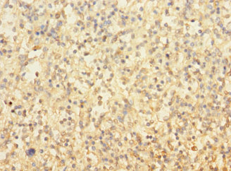 TUBAL3 Polyclonal Antibody