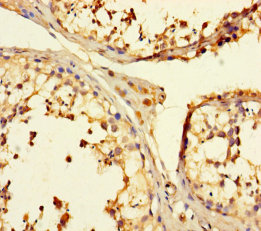 TULP3 Polyclonal Antibody