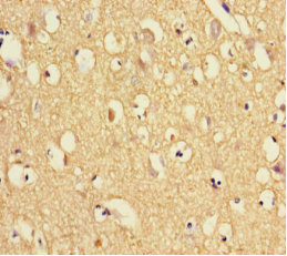 TXNDC9 Polyclonal Antibody