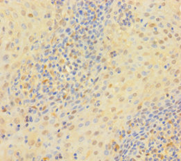 TYMP Polyclonal Antibody