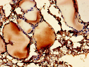 UBE2V1 Polyclonal Antibody